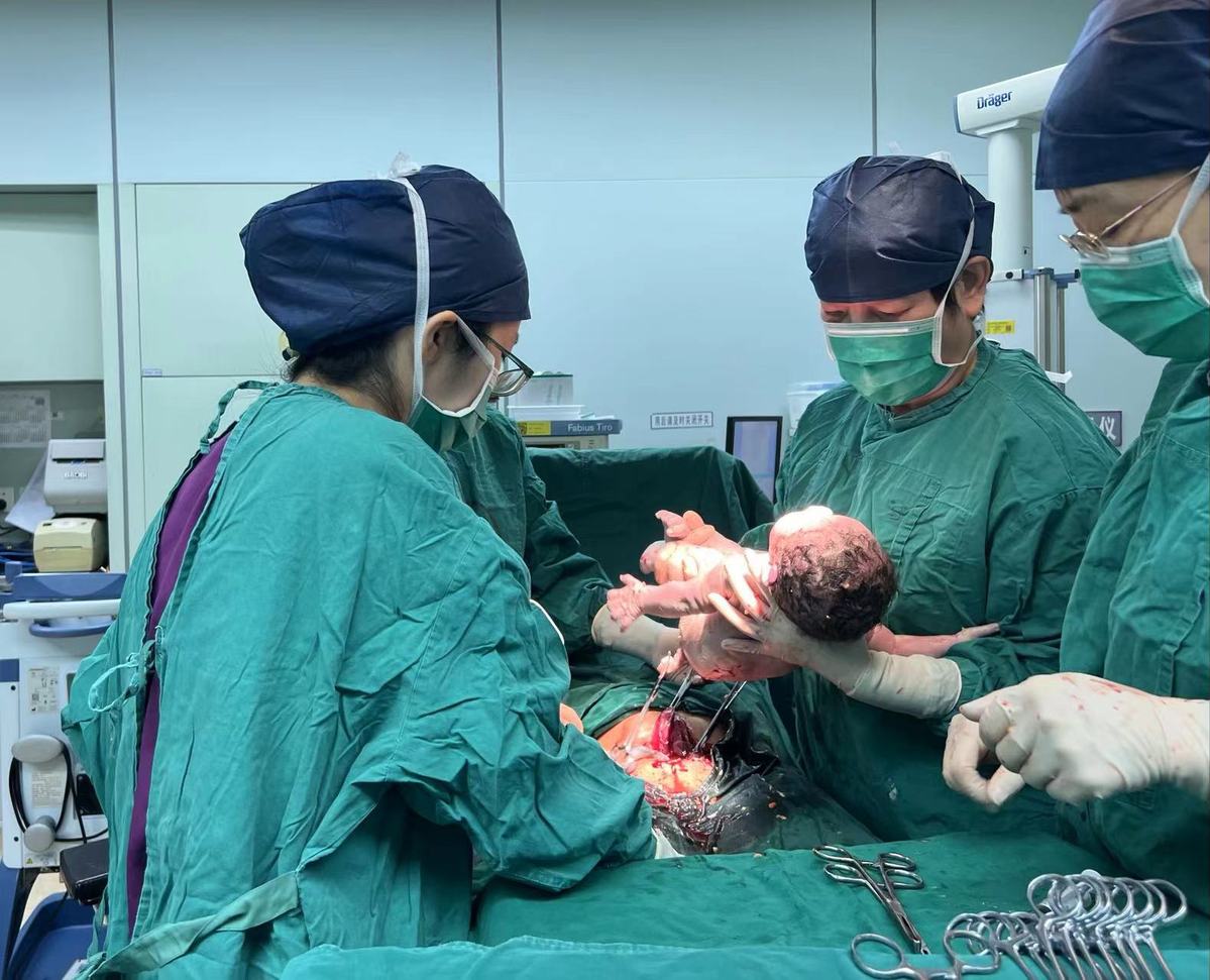 Seorang bayi perempuan dilahirkan dalam keadaan sehat di Shanghai melalui teknik canggih PGT-M (Preimplantation Genetic Testing for Monogenic)  atau PGT 