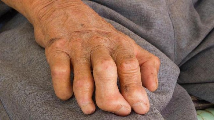 Indonesia menempati posisi ketiga di dunia