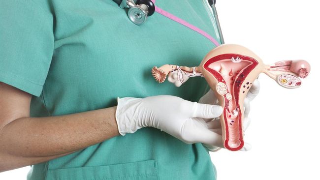 Tidak semua pasangan yang telah menikah ingin langsung memiliki momongan