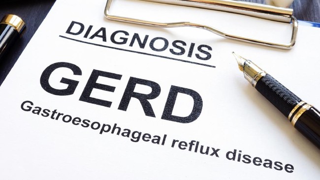 Puasa mungkin bisa jadi masalah bagi pengidap gastroeophageal reflux disease (GERD)
