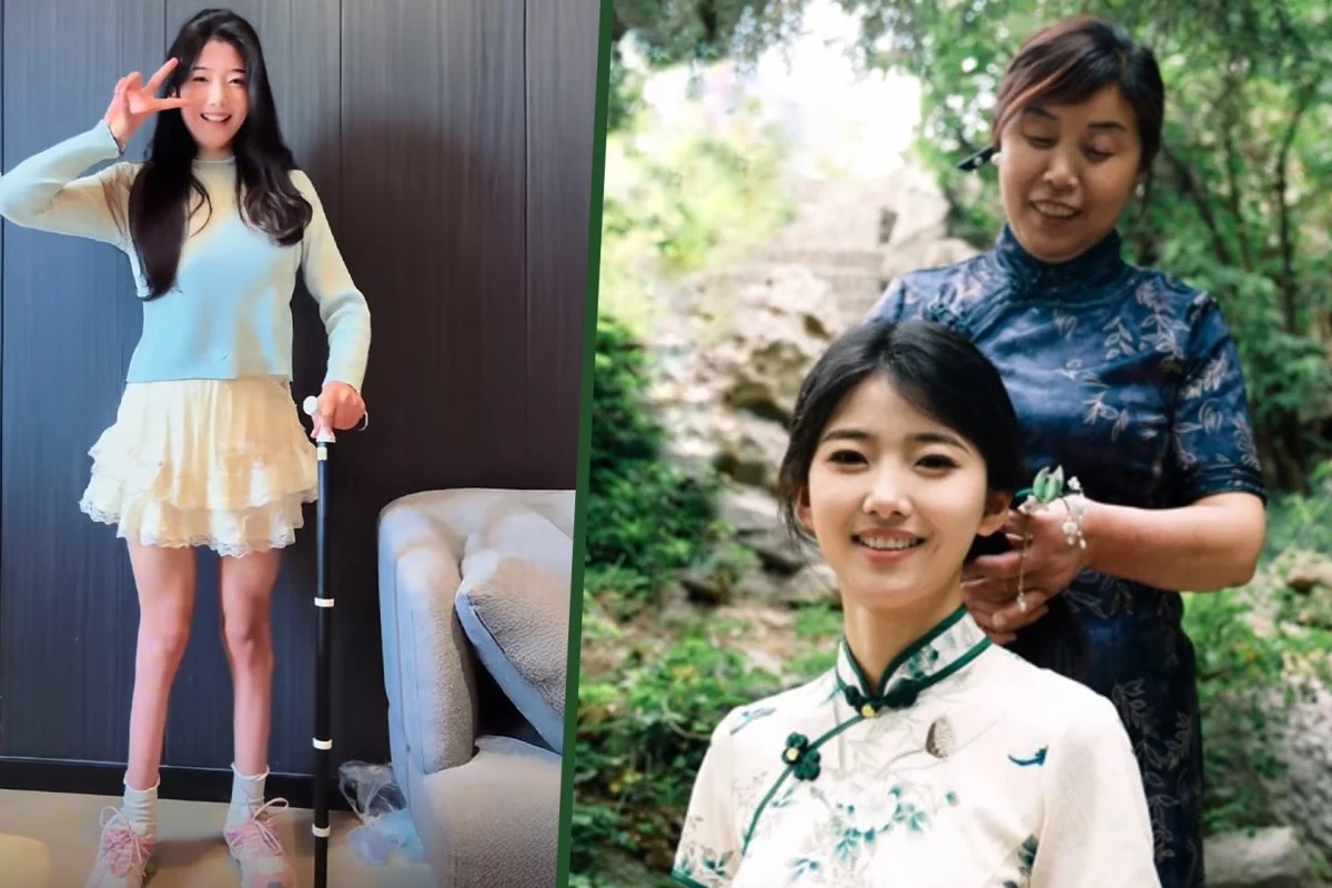 Liu berjalan dengan gaya berjalan tidak stabil karena atrofi otot di tungkai bawah dia dengan sayang menyebut dirinya Waiwai yang berarti &#039;bengkok&#039;